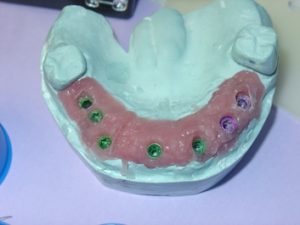 Step 2 - Chicago Dentist