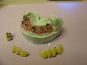 Step 3 - Chicago Dentist