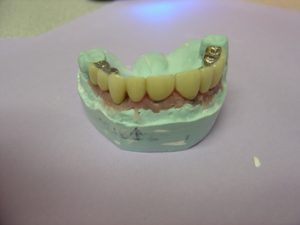 Step 4 - Chicago Dentist