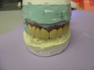 Step 5 - Chicago Dentist